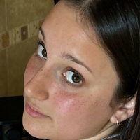 keshaortegafree Nude